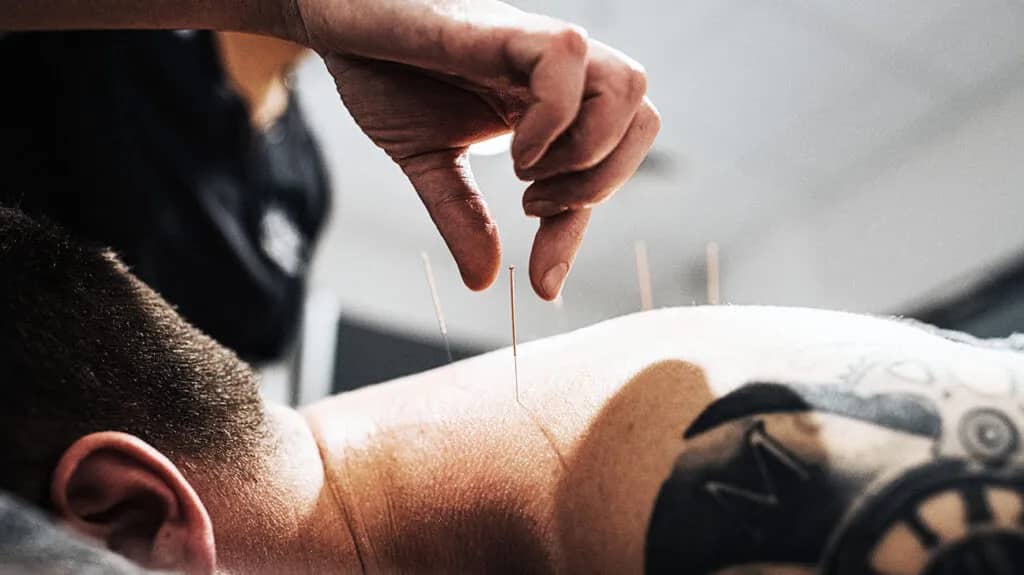 What Does An Acupuncture Do?